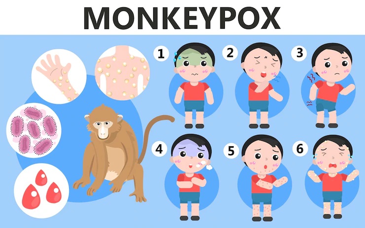 signs and symptoms of monkeypox